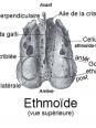 Somato - Ethmoïde